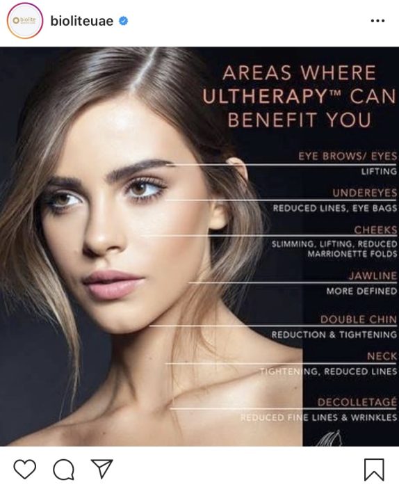 Benefits of Ultherapy