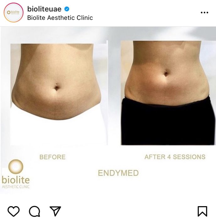 Treatments for lower body