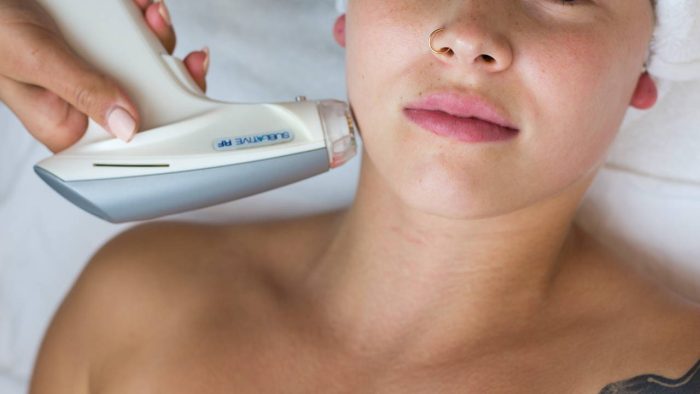 acne treatment e-matrix