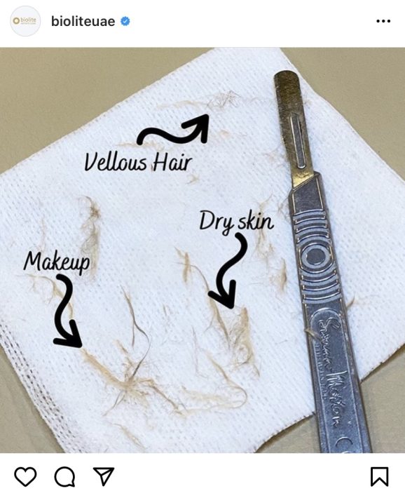 dermaplaning near me