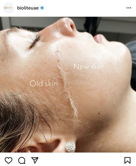 dermaplaning near me