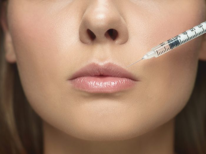 what are dermal fillers