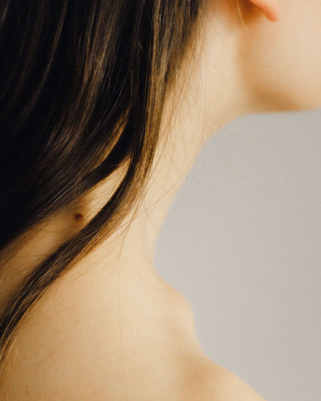 Looking For A Skin Tag Removal Treatment? Here’s Your Answer