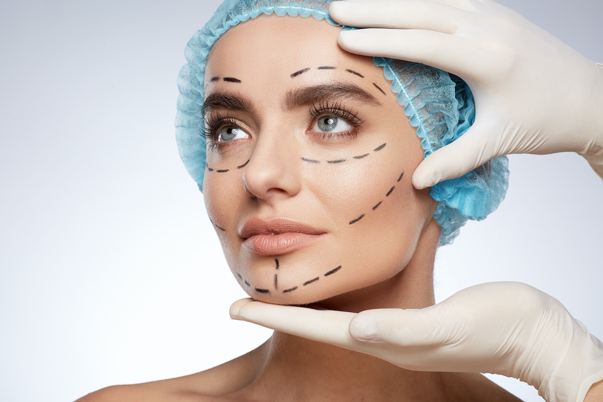 Thread Lifts: Your Non-Surgical Solution for Aging