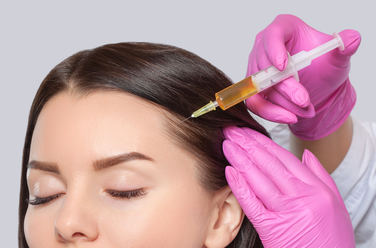Exosome Injections for Hair Growth