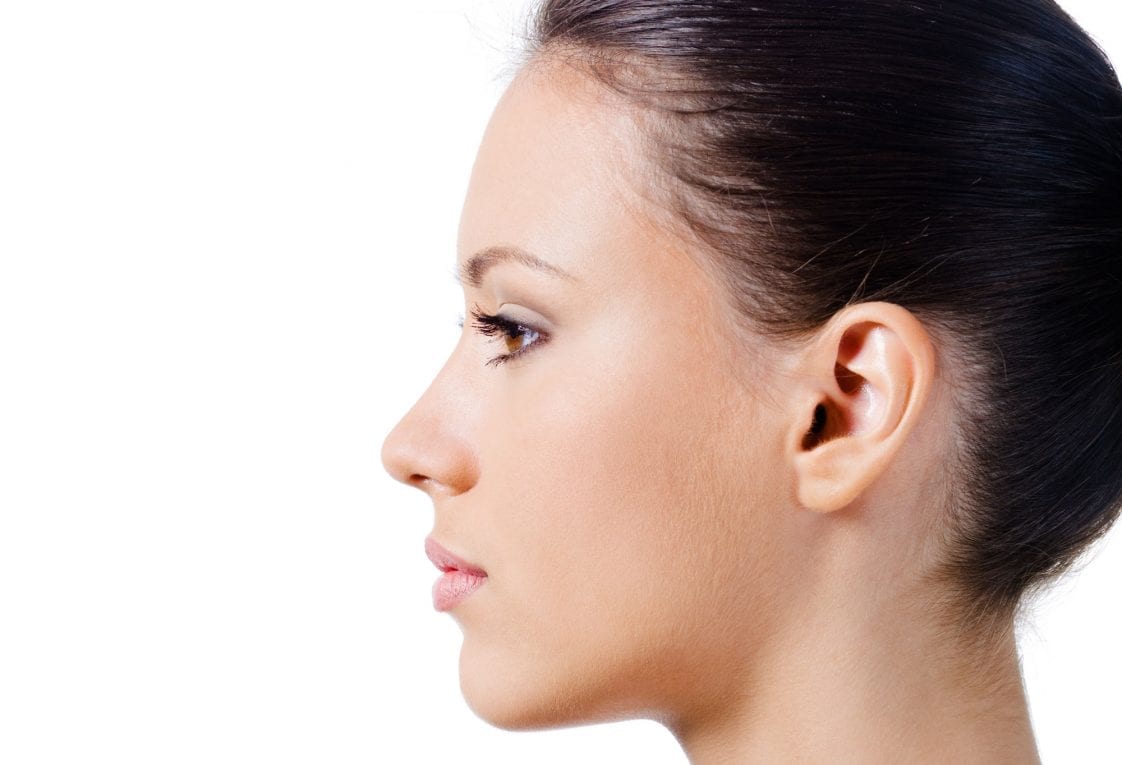 What is an Otoplasty?